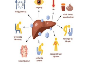 Felcsapta a fejét a Hepatitis-A az Esztergomi Járásban