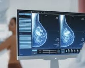 100 millió forintból vásárolhat új mammográfiás gépet az esztergomi kórház