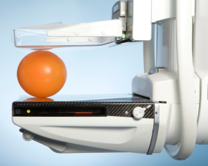 Mammográfiás szűrőgép érkezik az esztergomi kórházba